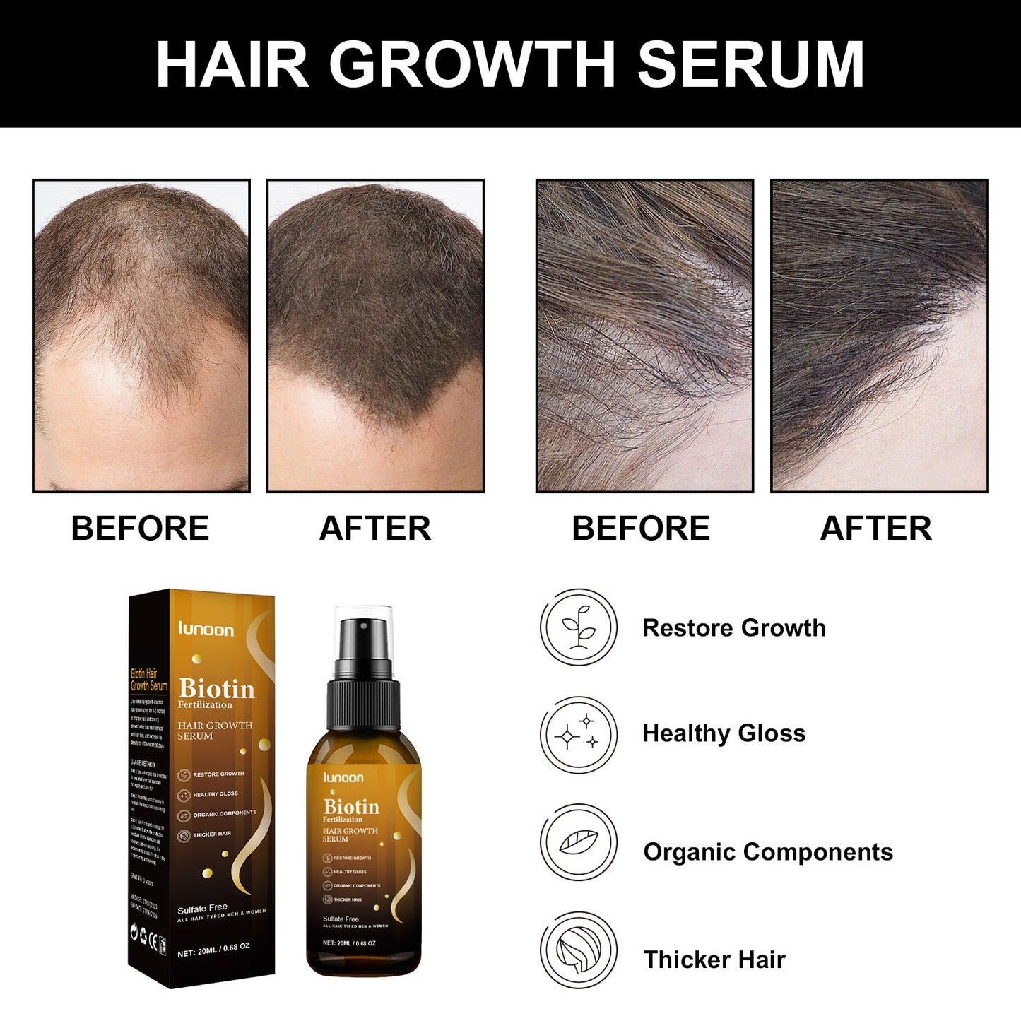 Biotin Hair Growth Spray Strong And Tough Anti-fall 20 ML 2459b4dd-b923-453a-9e37-635e01d27d69