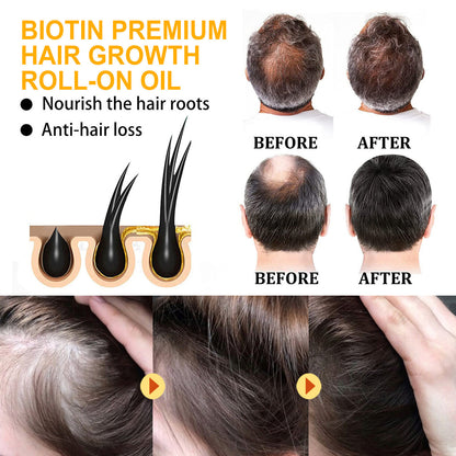 Biotin Dense Hair Series Deep Cleaning 4814a9fe-d7e7-47bd-9000-a84e6190c088