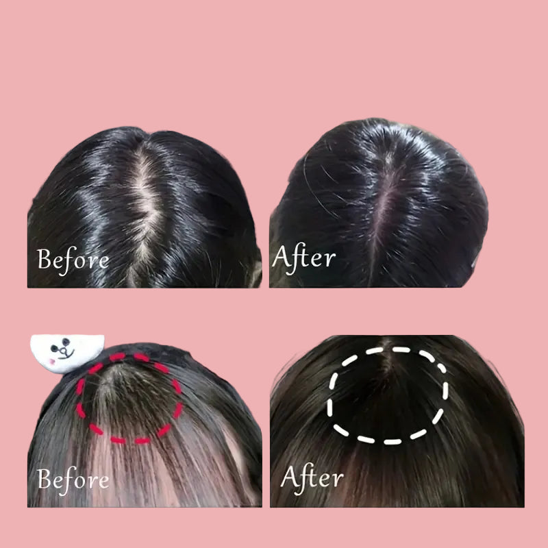 Hair Care Red Light Vibration Scalp Care Device