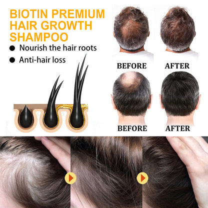 Biotin Anti-hair Loss Anti-dandruff Oil Control Nourishing Shampoo d974665a-dc54-48fc-8053-29e6cf3a6cf1